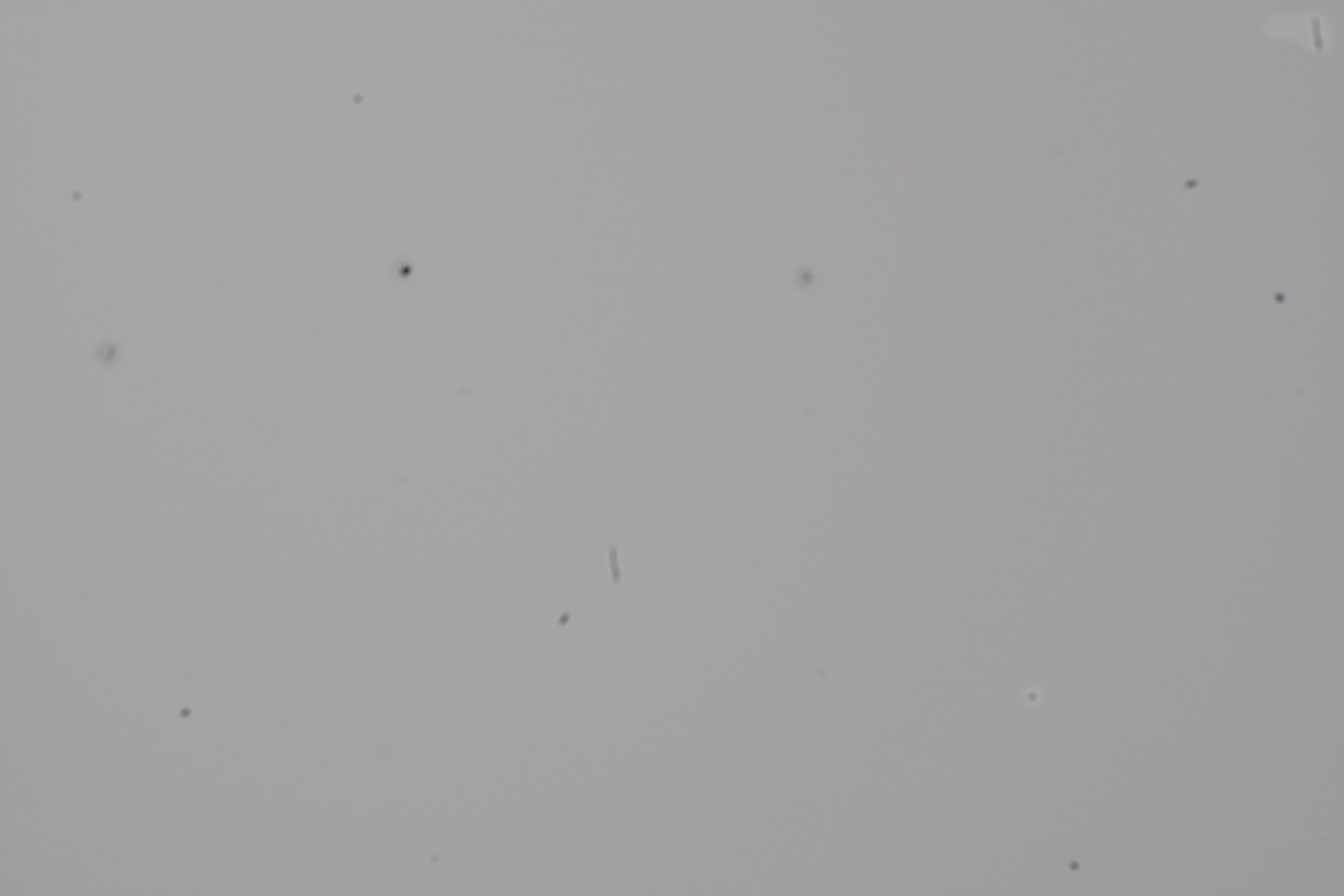 Before (dusty sensor)